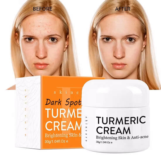 Ailke Face Set illuminante per la rimozione delle macchie scure Cura della pelle Crema sbiancante per il viso